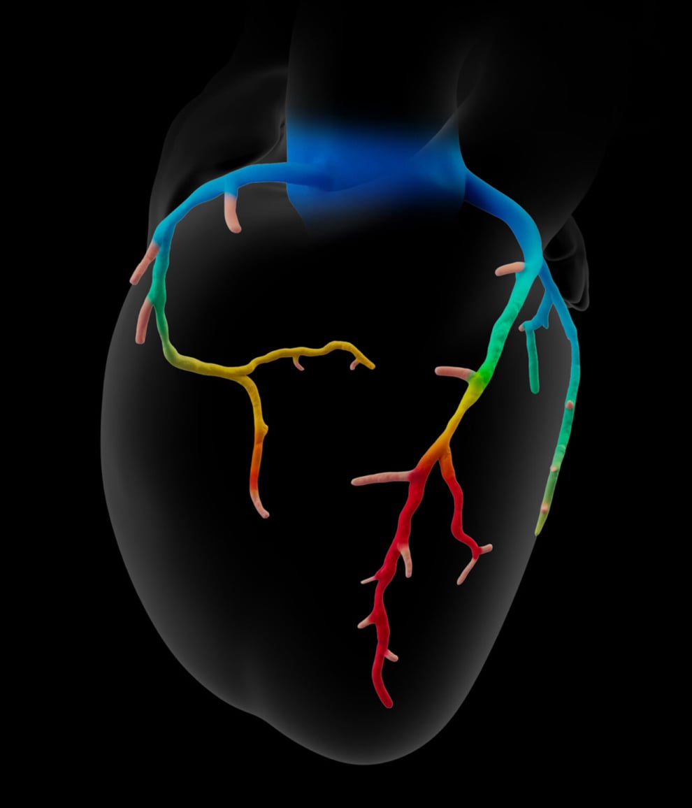  image of a heart